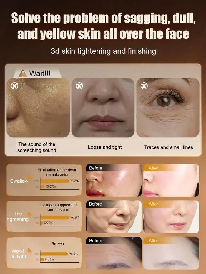 Anti-Wrinkle Forehead (Pack of 2) 100ml Each